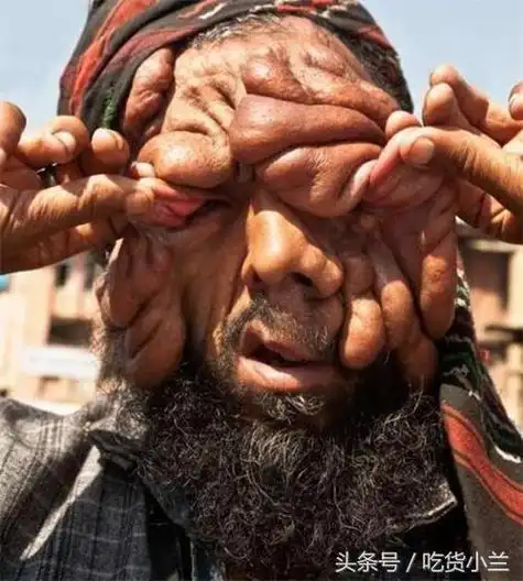 印度怪脸男子长相奇丑和妻子生下的孩子是这样的