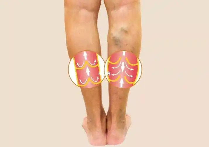 肾经,肝经,胃经,膀胱经,胆经,主管人体的分泌和排毒,所以,腿部受寒淤